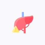 Alcoholic-liver-disease
